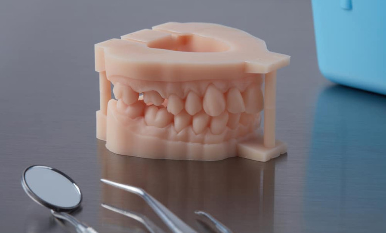 Digital dentistry and dental 3D printer workflow